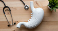 Long Covid May Physically Damage The Nerves That Control The Stomach