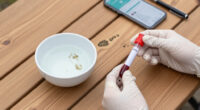 Manila Leptospirosis Cases Continue To Rise - Outbreak News Today